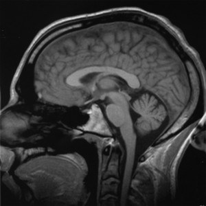 Brain_chrischan
