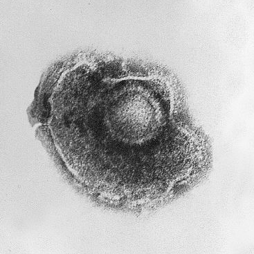 Varicella_(Chickenpox)_Virus_PHIL_1878_lores