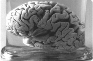 Cerebro de Levorgne