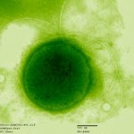 Thermococcus gammatolerans